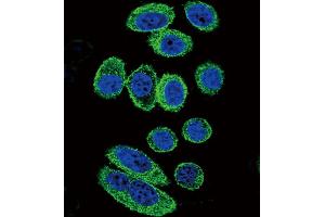 Confocal immunofluorescent analysis of ACTA1/α-actin Antibody (C-term)  with A549 cell followed by Alexa Fluor 488-conjugated goat anti-rabbit lgG (green). (Actin antibody  (C-Term))