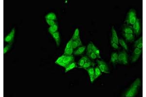 Immunofluorescent analysis of Hela cells using ABIN7161282 at dilution of 1:100 and Alexa Fluor 488-congugated AffiniPure Goat Anti-Rabbit IgG(H+L) (NEUROD1 antibody  (AA 154-356))