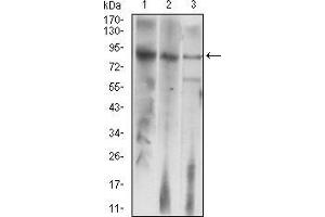 Western blot analysis using LHCGR mouse mAb against HepG2 (1), Jurkat (2), and SMMC-7721 (3) cell lysate.