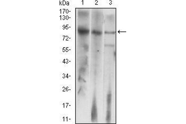LHCGR anticorps