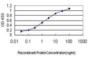 Detection limit for recombinant GST tagged ERN1 is approximately 0. (ERN1 antibody  (AA 401-500))