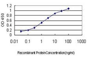 Detection limit for recombinant GST tagged ERN1 is approximately 0. (ERN1 antibody  (AA 401-500))