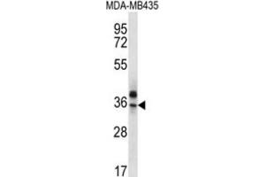 Western Blotting (WB) image for anti-Olfactory Receptor, Family 51, Subfamily Q, Member 1 (OR51Q1) antibody (ABIN2996658)
