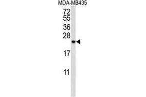 Western blot analysis of IL10 (arrow) in MDA-MB435 cell line lysates (35ug/lane) using Interleukin-10 / IL10 (IL-10 antibody  (Middle Region))