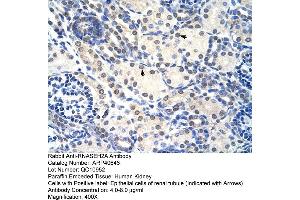 Rabbit Anti-RNASEH2A Antibody  Paraffin Embedded Tissue: Human Kidney Cellular Data: Epithelial cells of renal tubule Antibody Concentration: 4. (RNASEH2A antibody  (C-Term))