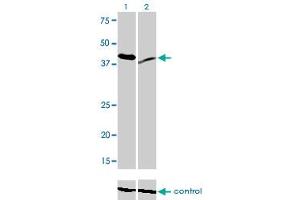 Western blot analysis of RAD23A over-expressed 293 cell line, cotransfected with RAD23A Validated Chimera RNAi (Lane 2) or non-transfected control (Lane 1). (RAD23A antibody  (AA 151-250))