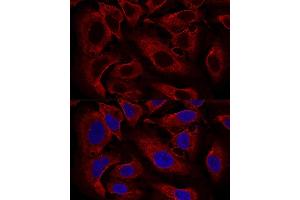 Confocal immunofluorescence analysis of U2OS cells using B Polyclonal Antibody (ABIN6131419, ABIN6137118, ABIN6137119 and ABIN6224820) at dilution of 1:100. (ARL8B antibody  (AA 127-186))