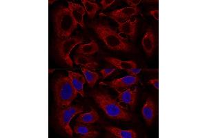 Confocal immunofluorescence analysis of U2OS cells using B Polyclonal Antibody (ABIN6131419, ABIN6137118, ABIN6137119 and ABIN6224820) at dilution of 1:100. (ARL8B antibody  (AA 127-186))