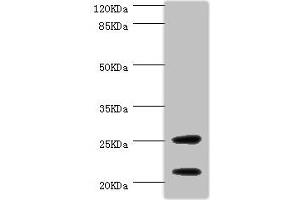 Western blot All lanes: CSRP3 antibody at 1 μg/mL + Mouse skeletal muscle tissue Secondary Goat polyclonal to rabbit IgG at 1/10000 dilution Predicted band size: 21 kDa Observed band size: 21, 25 kDa (CSRP3 antibody  (AA 1-194))