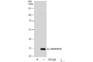 IP Image Immunoprecipitation of Annexin IV protein from HepG2 whole cell extracts using 5 μg of Annexin IV antibody, Western blot analysis was performed using Annexin IV antibody, EasyBlot anti-Rabbit IgG  was used as a secondary reagent. (Annexin IV antibody)
