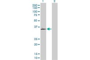 Western Blot analysis of OLR1 expression in transfected 293T cell line by OLR1 MaxPab polyclonal antibody. (OLR1 antibody  (AA 1-273))
