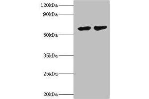 Western blot All lanes: CYP4F12 antibody at 6 μg/mL Lane 1: Mouse small intestine tissue Lane 2: Rat liver tissue Secondary Goat polyclonal to rabbit IgG at 1/10000 dilution Predicted band size: 61, 12 kDa Observed band size: 61 kDa (CYP4F12 antibody  (AA 265-524))