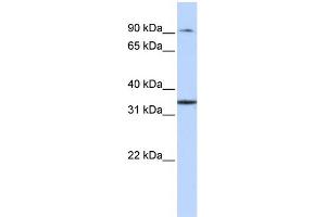 WB Suggested Anti-ZFP90 Antibody Titration: 0. (ZNF90 antibody  (Middle Region))
