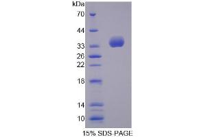 SDS-PAGE analysis of Mouse TBCB Protein. (TBCB Protein)