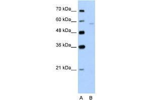 WB Suggested Anti-SLC22A7 Antibody Titration:  5. (SLC22A7 antibody  (N-Term))