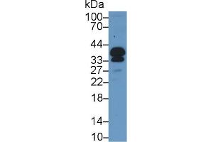 Western Blot; Sample: Mouse Serum; Primary Ab: 1µg/ml Rabbit Anti-Mouse POMC Antibody Second Ab: 0. (POMC antibody  (AA 27-235))