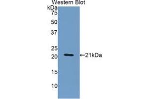 WB of Protein Standard: different control antibodies against Highly purified E. (ORM1 ELISA Kit)