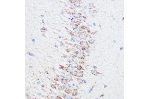 Immunohistochemistry of paraffin-embedded rat brain using SIRT4 Rabbit pAb (ABIN6129330, ABIN6147796, ABIN6147797 and ABIN6223494) at dilution of 1:100 (40x lens). (SIRT4 antibody  (AA 29-260))