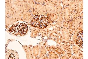 Immunohistochemistry (IHC) image for anti-Tumor Protein P53 (TP53) (pSer392) antibody (ABIN6256312)