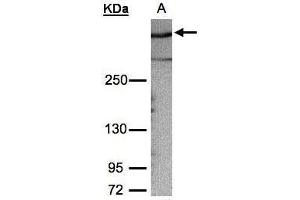 WB Image Sample (30μg whole cell lysate) A:HeLa S3, 5% SDS PAGE antibody diluted at 1:1000 (AKAP12 antibody  (C-Term))