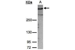 WB Image Sample (30μg whole cell lysate) A:HeLa S3, 5% SDS PAGE antibody diluted at 1:1000 (AKAP12 antibody  (C-Term))
