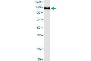 Immunoprecipitation of PHC1 transfected lysate using anti-PHC1 MaxPab rabbit polyclonal antibody and Protein A Magnetic Bead , and immunoblotted with PHC1 purified MaxPab mouse polyclonal antibody (B01P) . (PHC1 antibody  (AA 1-957))