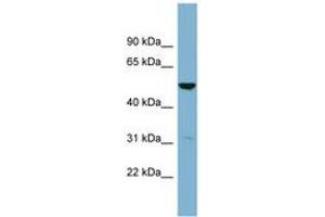 Image no. 1 for anti-Serine Dehydratase-Like (SDSL) (C-Term) antibody (ABIN6743388) (SDSL antibody  (C-Term))