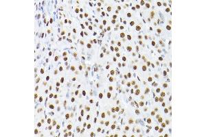 Immunohistochemistry (IHC) image for anti-Tripartite Motif Containing 28 (TRIM28) (AA 576-835) antibody (ABIN1683037)