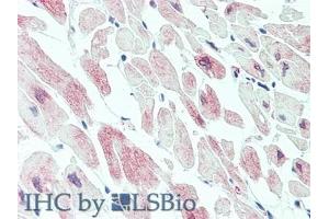 Detection of MYLK3 in Human Heart Tissue using Polyclonal Antibody to Myosin Light Chain Kinase 3 (MYLK3) (MYLK3 antibody  (AA 555-786))