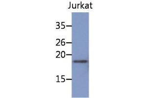 The cell lysate of Jurkat (30ug) were resolved by SDS-PAGE, transferred to PVDF membrane and probed with anti-human NBL1 antibody (1:1000).