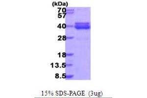 SDS-PAGE (SDS) image for 5'-Nucleotidase, Cytosolic III-Like (NT5C3L) (AA 1-300) protein (His tag) (ABIN5853976) (NT5C3L Protein (AA 1-300) (His tag))