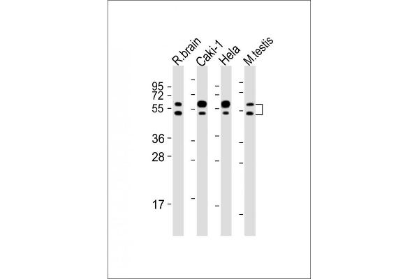 CDKL3 antibody  (AA 2-34)