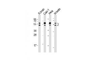 All lanes : Anti-CDKL3 Antibody (N-Term) at 1:2000 dilution Lane 1: rat brain lysates Lane 2: Caki-1 whole cell lysates Lane 3: Hela whole cell lysates Lane 4: mouse testis lysates Lysates/proteins at 20 μg per lane. (CDKL3 antibody  (AA 2-34))