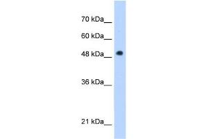 WB Suggested Anti-PNPLA3 Antibody Titration:  1 ug/ml  Positive Control:  Jurkat cell lysate (PNPLA3 antibody  (C-Term))