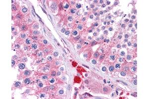 Immunohistochemistry (IHC) image for anti-Glutathione S-Transferase mu 1 (GSTM1) (C-Term) antibody (ABIN2776985)