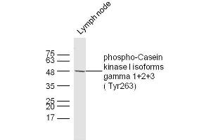 Mouse lymph node lysates probed with Casein kinase I isoforms gamma 1+2+3 (Tyr263) Polyclonal Antibody, unconjugated  at 1:300 overnight at 4°C followed by a conjugated secondary antibody at 1:10000 for 60 minutes at 37°C. (CSNK1G1, CSNK1G2, CSNK1G3 (pTyr263) antibody)