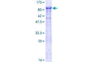 P4HTM Protein (AA 1-563) (GST tag)