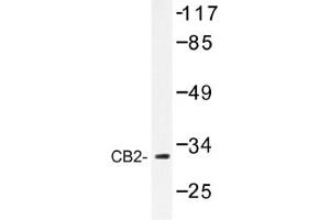 Image no. 1 for anti-Cannabinoid Receptor 2 (CNR2) antibody (ABIN317647) (CNR2 antibody)