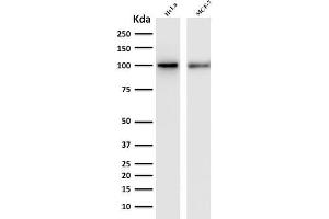 Western Blot Analysis of human HeLa and MCF-7 cell lysate with ENAH / MENA Mouse Monoclonal Antibody (ENAH/1988). (ENAH antibody  (AA 485-589))