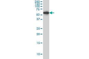 HDAC1 monoclonal antibody (M06), clone 1D6 Western Blot analysis of HDAC1 expression in Hela S3 NE . (HDAC1 antibody  (AA 1-482))