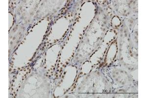 Image no. 5 for anti-Decapping Enzyme, Scavenger (DCPS) (AA 1-338) antibody (ABIN599227) (DCPS antibody  (AA 1-338))
