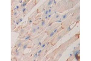 Immunohistochemistry (IHC) image for anti-P-Cadherin (CDH3) (AA 565-822) antibody (ABIN1858339)