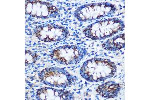 Immunohistochemistry of paraffin-embedded Human colon using TGN46/TGN46/TGOLN2 Rabbit pAb (ABIN7270876) at dilution of 1:100 (40x lens). (TGOLN2 antibody)