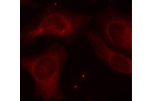 Immunofluorescence staining of methanol-fixed Hela cells using Phospho-NFKB1-S927 antibody. (NFKB1 antibody  (pSer927))