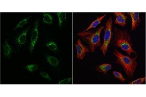 ICC/IF Image mtTFA antibody detects mtTFA protein at mitochondria by immunofluorescent analysis. (TFAM antibody)