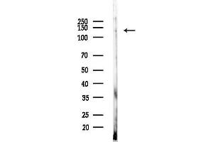 anti-DAZ Interacting Protein 3, Zinc Finger (DZIP3) (Internal Region) antibody