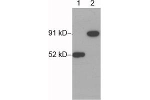 Western blot analysis of His-fusion protein (MW~91 kD) using 1 µg/mL Rabbit Anti-His-tag Polyclonal Antibody (ABIN398410) Lane 1: His-tag fusion protein expressed in E. (His Tag antibody)