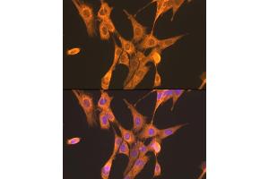 Immunofluorescence analysis of NIH/3T3 cells using PFKL antibody (ABIN7269308) at dilution of 1:100. (PFKL antibody  (AA 700-780))
