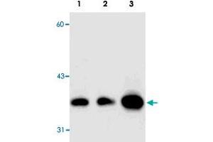 Western blot analysis of GAPDH expression in 293 (A) and HeLa (B) whole cell lysates and mouse kidney tissue extract (C) using GAPDH polyclonal antibody . (GAPDH antibody)