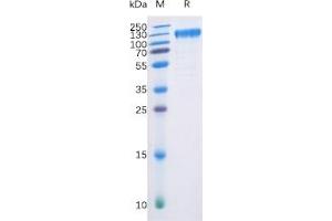Human FLT3, hFc-His Tag on SDS-PAGE under reducing condition. (FLT3 Protein (Fc-His Tag))